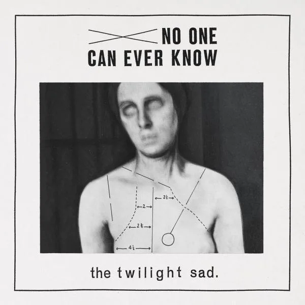 Twilight Sad // Nobody Wants To Be Here And Nobody Wants To Leave